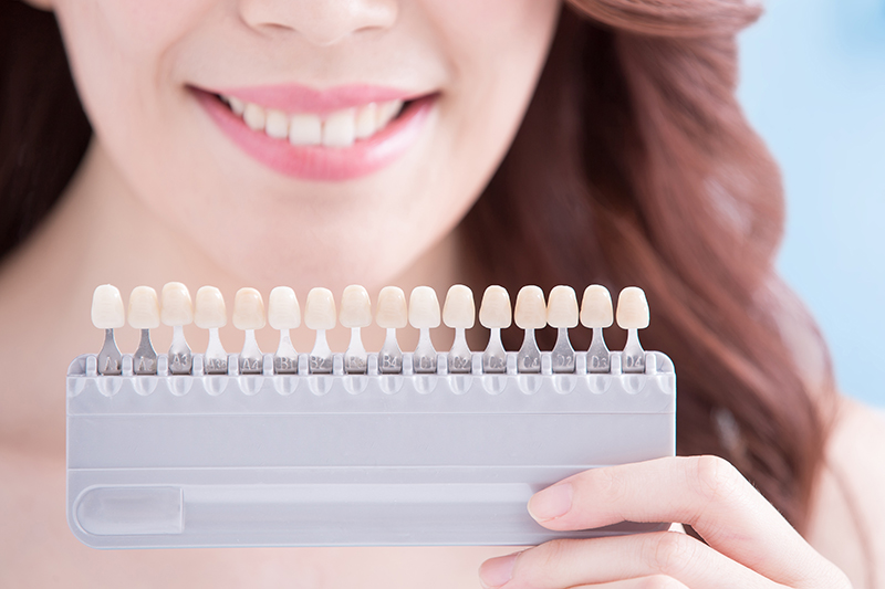 woman getting teeth whitening at the dentist